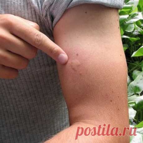 Эффективное средство от комаров - МирТесен