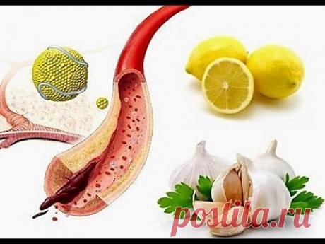 Очищение сосудов головного мозга