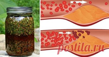 Печень очистится мгновенно! Укроп, мед, валериана — и сосуды без изъяна! Вас беспокоят захламленные бляшками сосуды, поэтому их-то надо почистить в первую очередь. Для этого приготовить вот такой настой: 1 стакан укропного семени, 2 ст. ложки молотого корня валерианы смешать, залить 2 литрами кипятка, когда настой остынет до 40 град., добавить 2 ст. ложки меда и настаивать сутки, …