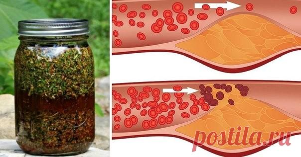 Печень очистится мгновенно! Укроп, мед, валериана — и сосуды без изъяна! Вас беспокоят захламленные бляшками сосуды, поэтому их-то надо почистить в первую очередь. Для этого приготовить вот такой настой: 1 стакан укропного семени, 2 ст. ложки молотого корня валерианы смешать, залить 2 литрами кипятка, когда настой остынет до 40 град., добавить 2 ст. ложки меда и настаивать сутки, …