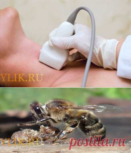 Прополис для щитовидной железы: лечение, рецепты