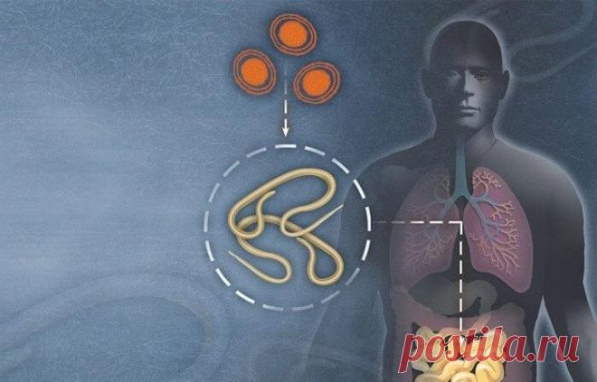 Как избавиться от паразитов: самые эффективные травы от глистов и лямблий