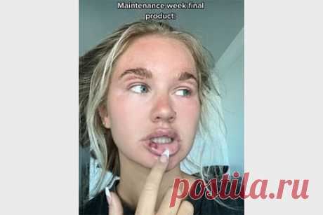 Девушка увеличила губы и нарастила ресницы за один раз и удивилась результату. Блогерша Марена Николь сделала несколько косметических процедур за один раз и удивилась результату. Юзерша увеличила губы, нарастила ресницы и скорректировала цвет и форму бровей. На кадрах видно, что губы девушки стали чересчур пухлыми. Также она показала темные выщипанные брови и ресницы неестественной длины.
