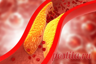 Статины и холестерин: польза, показания и возможные риски Холестерин в организме человека присутствует в нескольких формах. Основными из них являются липопротеины высокой плотности (ЛПВП) и липопротеины низкой плотности (ЛПНП).ЛПВП часто называют...