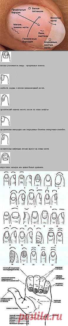 Гадание по ногтям