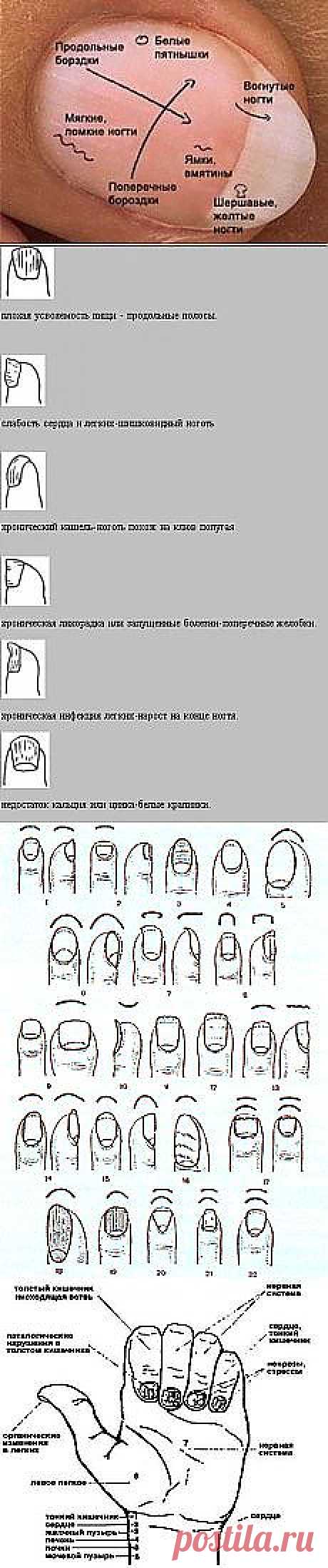 Гадание по ногтям