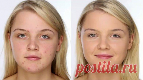 Маскируем прыщик - лёгкий способ
