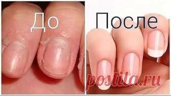 НОГТИ СТАНУТ БЕЛЫМИ И КРЕПКИМИ!
Чтобы ногти всегда выглядели ухоженными и были белыми, длинными и крепкими советую этот рецепт! Сама им пользуюсь, результат поражает!
Чтобы ногти всегда выглядели ухоженными и были белыми, длинными и крепкими советую этот рецепт! Сама им пользуюсь, результат поражает! Для этого нужно приготовить пасту, берем чайную ложку…Продолжение-
Для крепких и белых ногтей приготовьте пасту из: (все по пол чайной ложки)
- тертый картофель
- зубная паста...