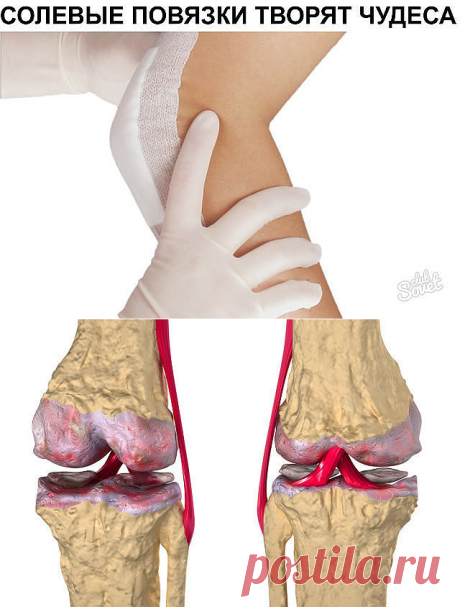 Это скрывали все хирурги! Так лечатся суставы дома за сутки