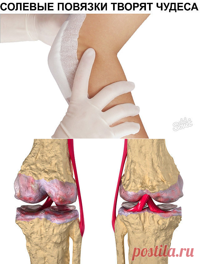 Это скрывали все хирурги! Так лечатся суставы дома за сутки