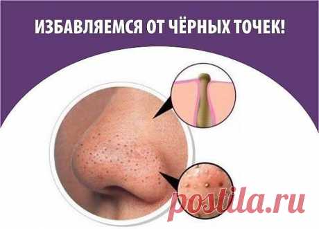 Еще раз про черные точки...