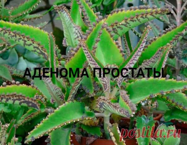 АДЕНОМА ПРОСТАТЫ

Нужно взять листья каланхоэ, нижние, промыть и пропустить через мясорубку, чтобы набрался 100-граммовый полный стаканчик, и эту смесь залить в бутылочку с широким горлышком. Туда же отправить 200 г водки, можно первача. Поставить в темное место на 10 дней, взбалтывать пару раз, потом процедить. Поместить бутылочку в холодильник на нижнюю полку и принимать утром натощак за 20 минут до еды по 1 ч. ложке. Вечером также до еды - 1 ч. ложку. Улучшение наступает незамедлительно.