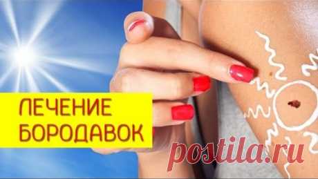 Аптечные препараты для лечения бородавок

Лечение лентиго. [Галина Гроссманн]
