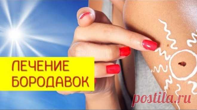 Аптечные препараты для лечения бородавок

Лечение лентиго. [Галина Гроссманн]