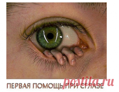 ПЕРВАЯ ПОМОЩЬ ПРИ СГЛАЗЕ