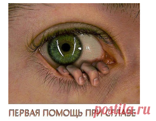 ПЕРВАЯ ПОМОЩЬ ПРИ СГЛАЗЕ