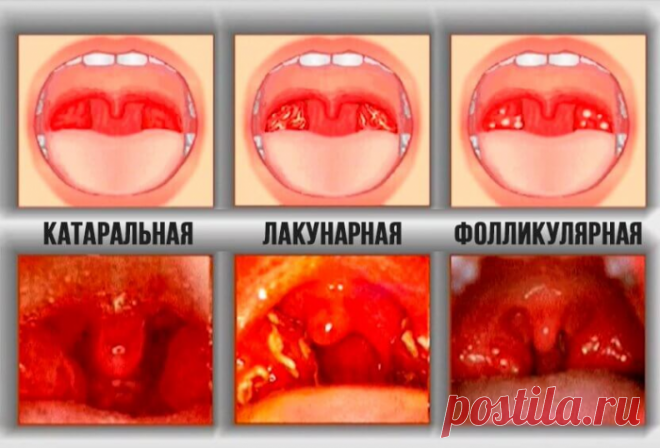10 детских болезней, которые должны уметь отличать все родители