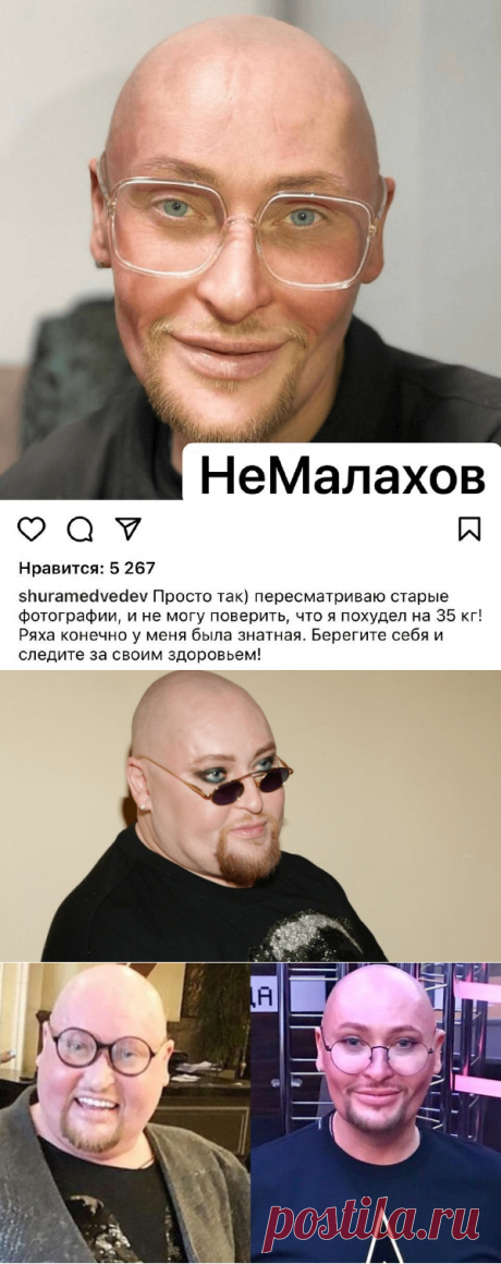 НАУЧНО ДОКАЗАНО: ОЖИРЕНИЕ ПРИВОДИТ К ОНКОЛОГИИ И СОКРАЩАЕТ ЖИЗНЬ НА 20 ЛЕТ

ЛИШНИЙ ВЕС ЧУТЬ НЕ УБИЛ ИЗВЕСТНОГО ПЕВЦА

“ПРЕВРАТИЛСЯ В СКЕЛЕТ!” ВЕСЬ РОССИЙСКИЙ ШОУ БИЗНЕС ОБСУЖДАЕТ РЕЗКОЕ ПОХУДЕНИЕ ШУРЫ НА 35 КГ
