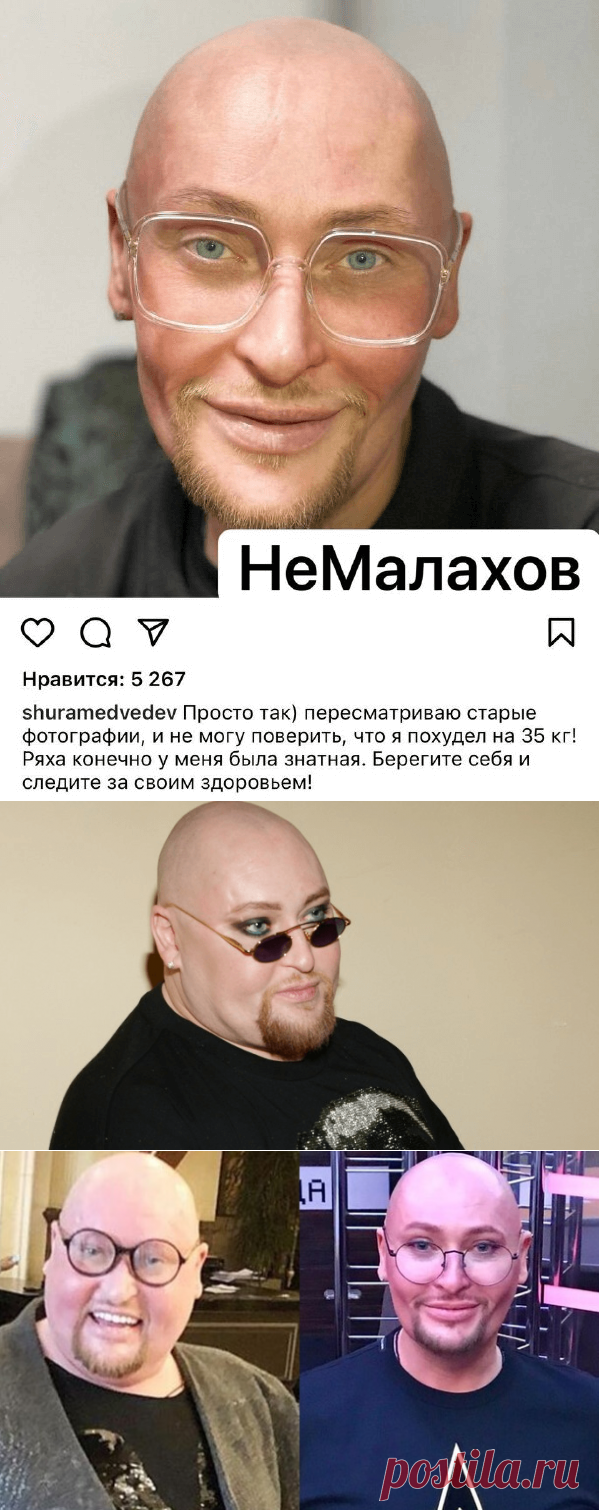 НАУЧНО ДОКАЗАНО: ОЖИРЕНИЕ ПРИВОДИТ К ОНКОЛОГИИ И СОКРАЩАЕТ ЖИЗНЬ НА 20 ЛЕТ

ЛИШНИЙ ВЕС ЧУТЬ НЕ УБИЛ ИЗВЕСТНОГО ПЕВЦА

“ПРЕВРАТИЛСЯ В СКЕЛЕТ!” ВЕСЬ РОССИЙСКИЙ ШОУ БИЗНЕС ОБСУЖДАЕТ РЕЗКОЕ ПОХУДЕНИЕ ШУРЫ НА 35 КГ
