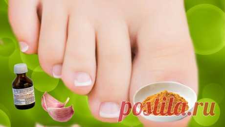 3 "копеечных" средства избавления от грибка ногтей без вреда для ногтевой пластины