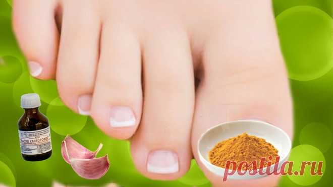 3 "копеечных" средства избавления от грибка ногтей без вреда для ногтевой пластины