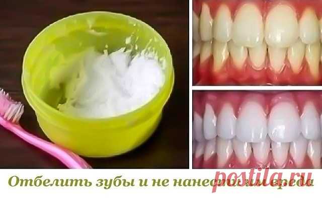Данный метод помогает практически при любых заболеваниях десен и при этом почти моментально отбеливает зубы, растворяет камень и залечивает маленькие ранки во рту. Ингредиенты: - 0,5 ч.л. питьевой соды добавить - 10-20 капель перекиси водорода (аптечной) - несколько капель лимона. В соду добавить перекись водорода и