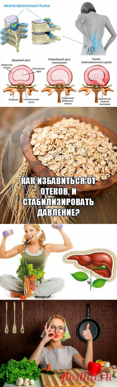 МЕЖПОЗВОНОЧНУЮ ГРЫЖУ МОЖНО ЛЕЧИТЬ СУХОФРУКТАМИ