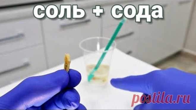 Идеальные Зубы. Соль+Сода