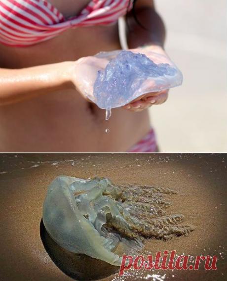 Что делать, если укусила медуза