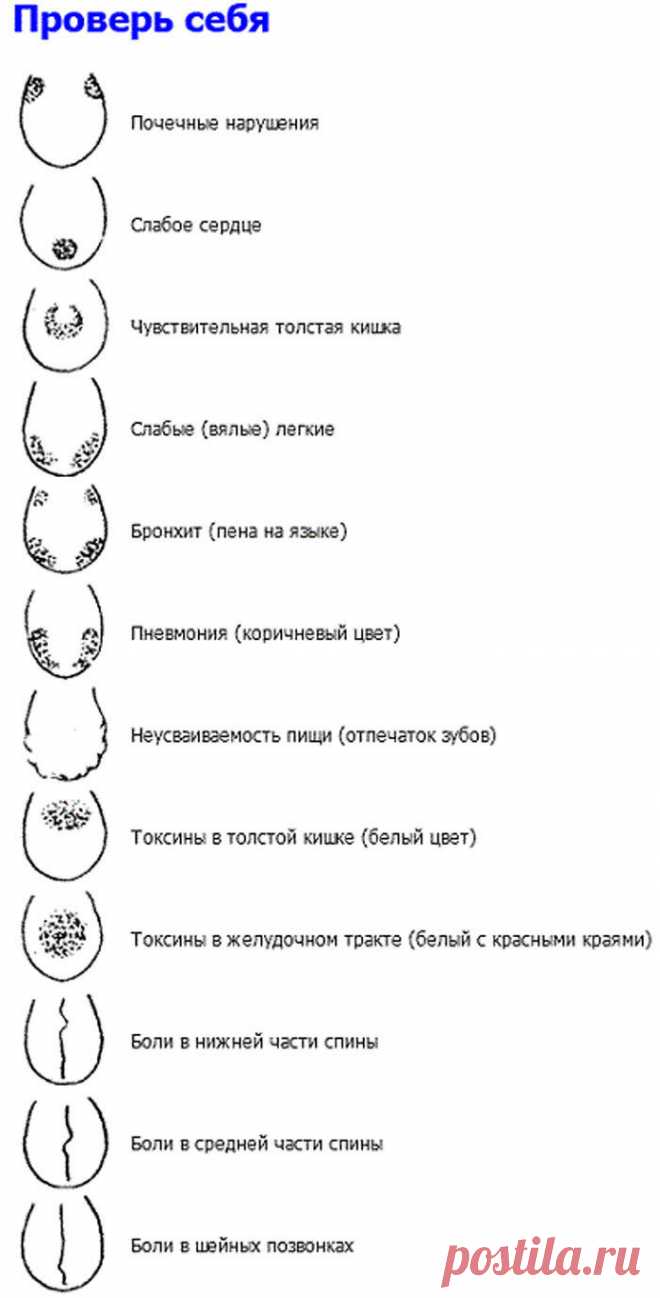 Проверьте себя! Язык расскажет о проблемах в организме