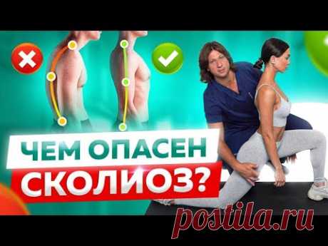 Что начать делать при сколиозе или кифозе? 7 упражнений для лечения позвоночника