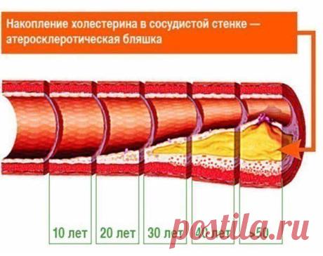 Проверенные поколениями народные средства для сосудов.(см.)