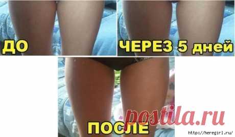 ГОРЧИЧНО-МЕДОВОЕ ОБЕРТЫВАНИЕ .