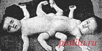 Cuando la barbarie quiso tener ojos azules - Internacionales - Juventud Rebelde - Diario de la juventud cubana