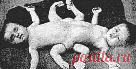 Cuando la barbarie quiso tener ojos azules - Internacionales - Juventud Rebelde - Diario de la juventud cubana