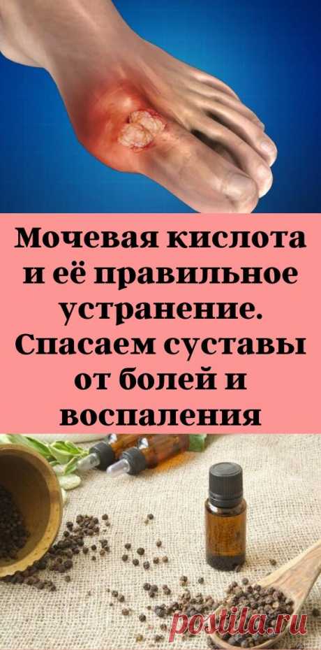 Мочевая кислота и её правильное устранение. Спасаем суставы от болей и воспаления