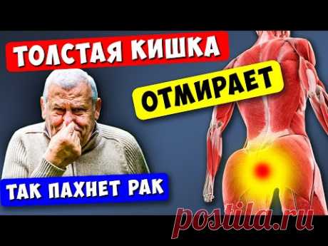 14 Признаков того, что Толстая КИШКА ОТМИРАЕТ! 90% даже НЕ Догадываются...