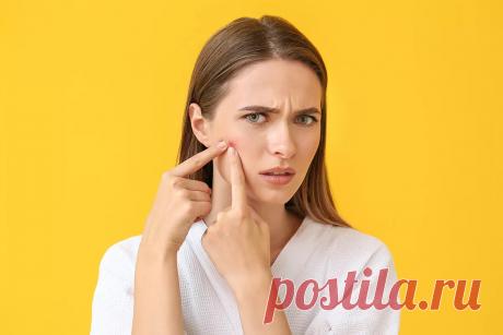 Можно ли через прыщи занести инфекцию?