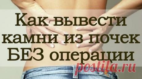 Как вывести камни из почек без операции за 3 дня!