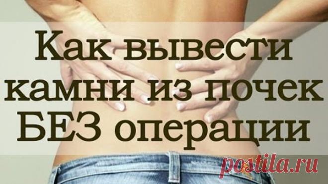 Как вывести камни из почек без операции за 3 дня!