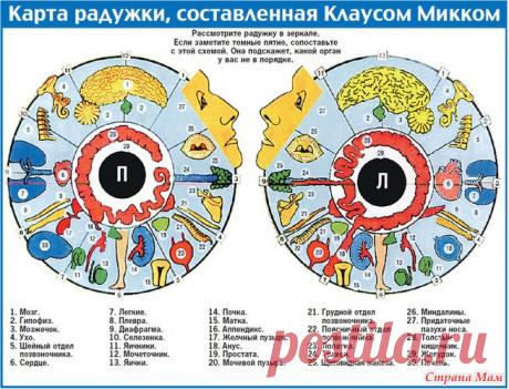 Информативная диагностика по радужной оболочке глаза. - Страна Мам