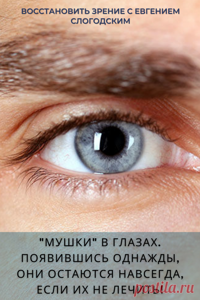 Мушки в глазах что это такое Зуд сухость глаз Деструкция стекловидного тела Как избавиться от плавающих мушек Нарушение зрения Вернуть зрение Помутнения перед глазами причины и лечение Средства для улучшения зрения Упражнения для глаз Мушки в глазах исчезают навсегда Плавающие помутнения точки паутинки перед глазами Болезни глаз Возрастное изменение Заболевания сетчатки Устают глаза Боль Плохое зрение Восстановить зрение с Евгением Слогодским без операции Гимнастика тренажёр для глаз Миодезопсия