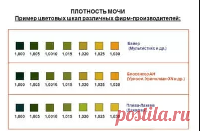 Диагностика заболеваний почек Биохимический анализ крови – устанавливает повышение концентрации мочевины (нормальная концентрация до 15 ммоль/л, или 90 мг/ 100 мл) и креатинина крови (нормальная концентрация 15,25—76,25 мкмоль/л или 0,2—1,0 мг/100 мл). В некоторых случая проводят исследования по определению антител антистрептолизина О (ASLO) – указывающих на бактериальную (стрептококковую) природу гломерулонефрита. В...