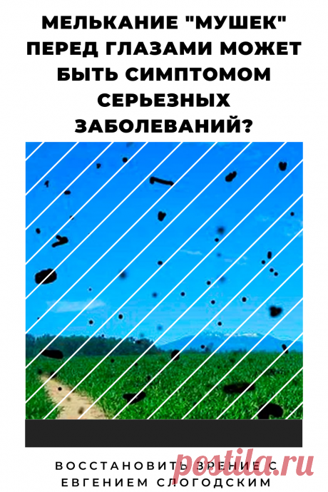 Мушки в глазах что это такое Зуд сухость глаз Деструкция стекловидного тела Как избавиться от плавающих мушек Нарушение зрения Вернуть зрение Помутнения перед глазами причины и лечение Средства для улучшения зрения Упражнения для глаз Мушки в глазах исчезают навсегда Плавающие помутнения точки паутинки перед глазами Болезни глаз Возрастное изменение Заболевания сетчатки Устают глаза Боль Плохое зрение Восстановить зрение с Евгением Слогодским без операции Гимнастика тренажёр для глаз Миодезопсия
