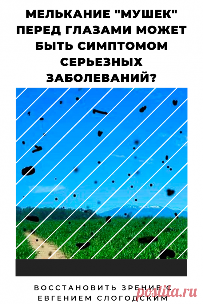 Мушки в глазах что это такое Зуд сухость глаз Деструкция стекловидного тела Как избавиться от плавающих мушек Нарушение зрения Вернуть зрение Помутнения перед глазами причины и лечение Средства для улучшения зрения Упражнения для глаз Мушки в глазах исчезают навсегда Плавающие помутнения точки паутинки перед глазами Болезни глаз Возрастное изменение Заболевания сетчатки Устают глаза Боль Плохое зрение Восстановить зрение с Евгением Слогодским без операции Гимнастика тренажёр для глаз Миодезопсия