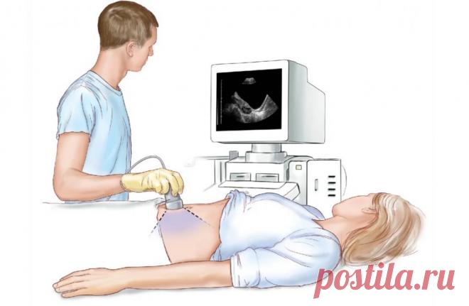 Подготовка к УЗИ брюшной полости: памятка пациенту