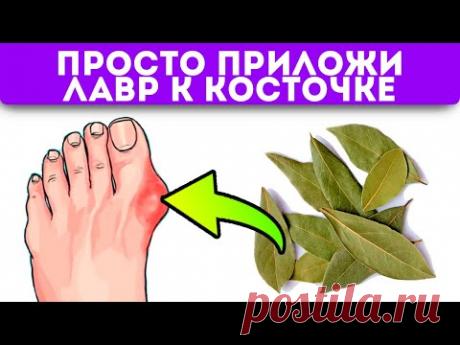 Избежал операции на ноге! Косточка на ноге рассосалась сразу после…Записывайте рецепт!