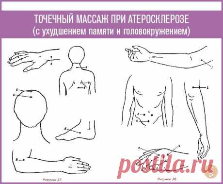ТОЧЕЧНЫЙ МАССАЖ ПРИ АТЕРОСКЛЕРОЗЕ (если сопровождается ухудшением памяти и головокружением)

Продолжаем публикации методики точечного массажа при атеросклерозе. Первая публикация здесь — https://ok.ru/alexeymamatov/topic/68933377037594

️ Если атеросклероз у вас сопровождается ухудшением памяти, то показан массаж следующих точек (рис. 37).

Точка 1. Симметричная, расположена на 2-3 мм от угла ногтевой лунки мизинца руки в сторону безымянного пальца. Больной сидит, положив ...