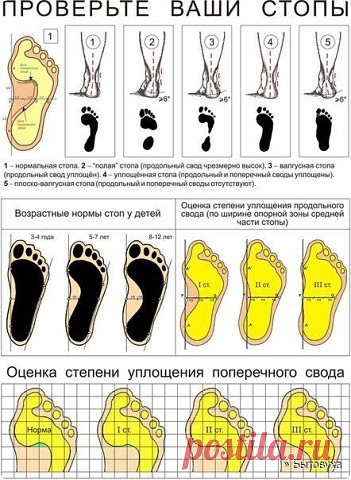 БЕРЕГИТЕ НОГИ! 


 
 





Пожалуйста, берегите ноги!
 
Если вы заметили,что у вас даже после недолгого хождения начинают болеть ступни, на большом пальце появилась выпирающая косточка и она растет в размерах, то да…