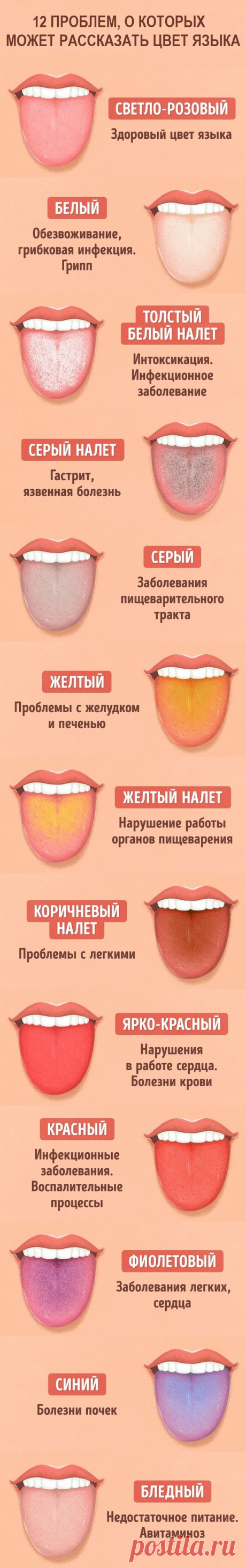 12 проблем о которых может рассказать цвет языка